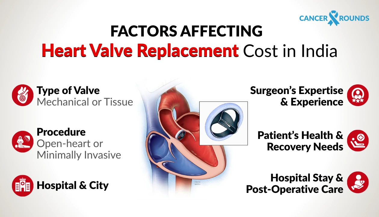 factors affecting heart valve replacement cost India