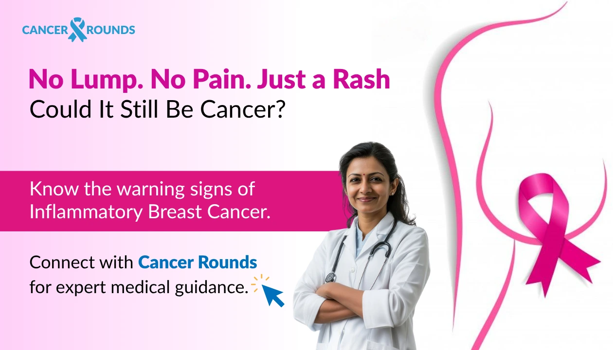 inflammatory breast cancer rash