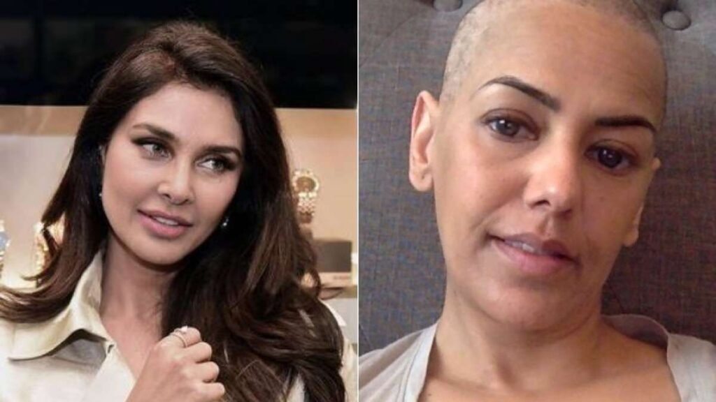 Lisa Ray’s multiple myeloma symptoms